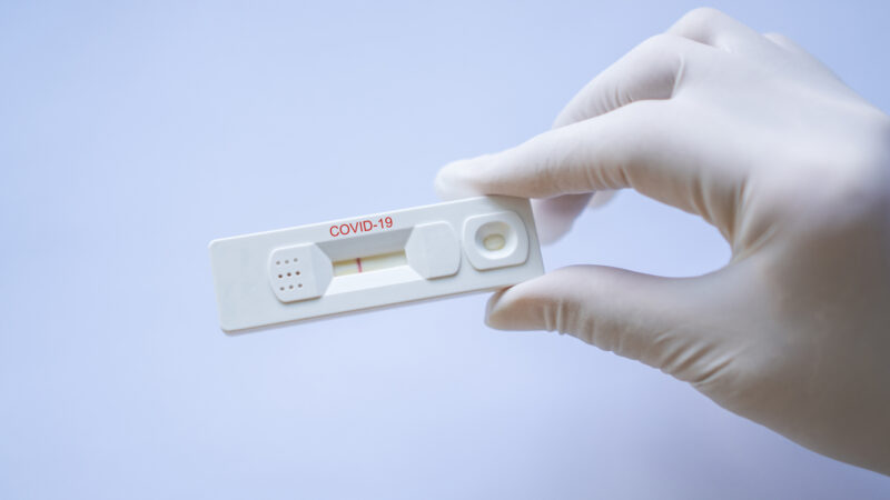 Kostenlose Corona-Bürgertests